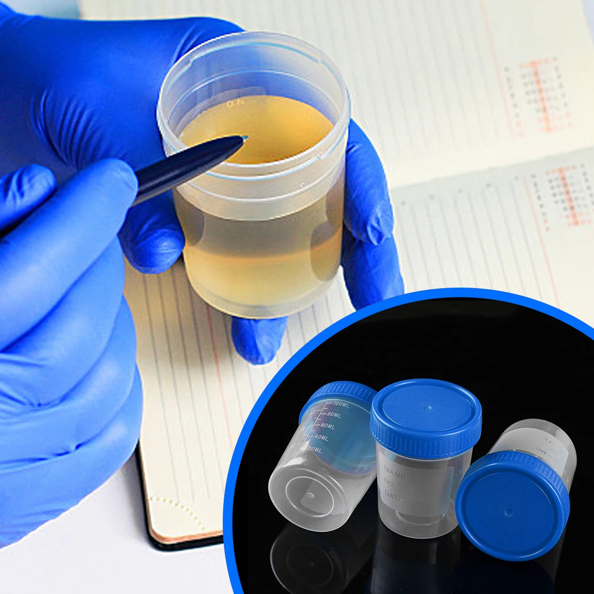 recoltarea urinei pentru proba cu trei pahare supozitoare proctozate pentru recenzii de prostatită